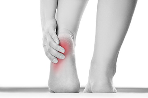 Plantar Fasciitis