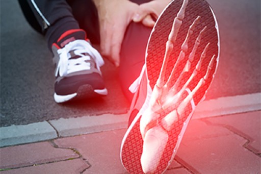 Foot and Ankle Injuries in Runners