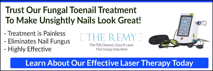 remy laser